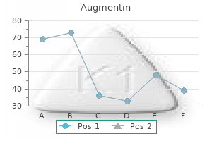 1000 mg augmentin cheap fast delivery