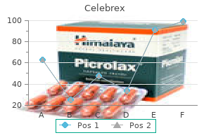 celebrex 100 mg without a prescription
