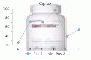 ciplox 500 mg order with amex