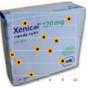 Stimulant psychosis