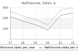 naltrexone 50 mg generic amex