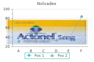 cheap 10 mg nolvadex mastercard